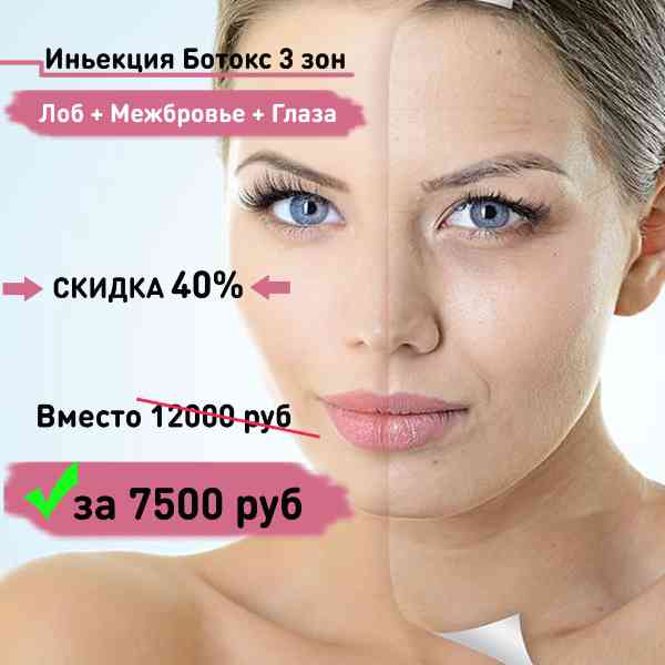 Через сколько ложится ботокс. Сколько единиц ботокса нужно для лба. Ботокс в межбровье схема. Схема введения ботокса на лице. Схема введения ботокса на лице.